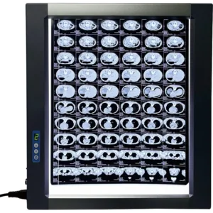 Easywell MST-4000II Double Panel LED X-ray Viewer