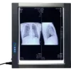 Easywell MST-4000I Single-Panel LED X-ray Film Viewer