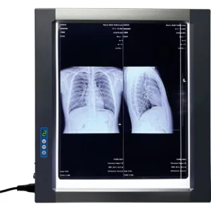 Easywell MST-4000I Single-Panel LED X-ray Film Viewer