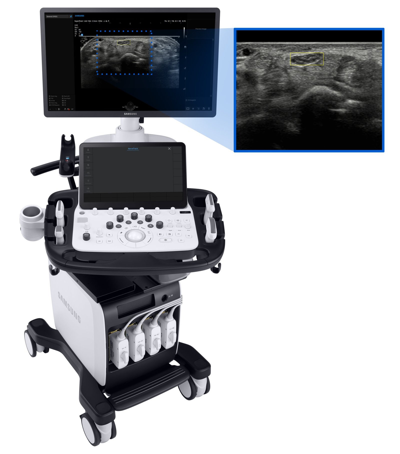 Samsung V8 General Imaging Ultrasound