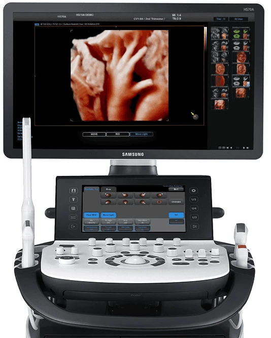 Samsung HS30 Ultrasound Samsung HS30 Ultrasound
