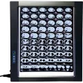 Easywell MST-4000II Double Panel LED X-ray Viewer