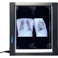 Easywell MST-4000I Single-Panel LED X-ray Film Viewer