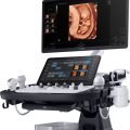 Samsung V7 Ultrasound Machine